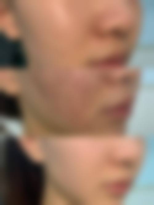 求美者真实反馈