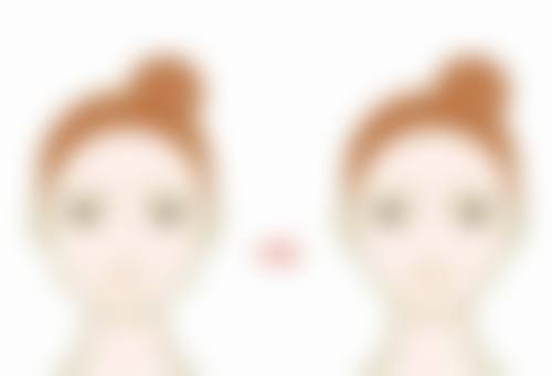 刘明明依托专精医美平台开展定制服务