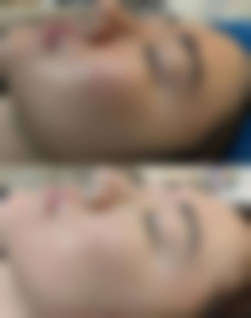 求美者真实反馈