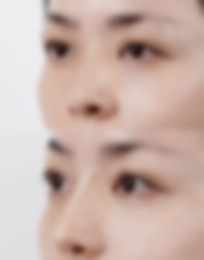 求美者真实反馈