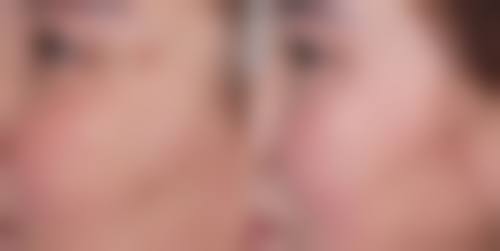 求美者真实反馈