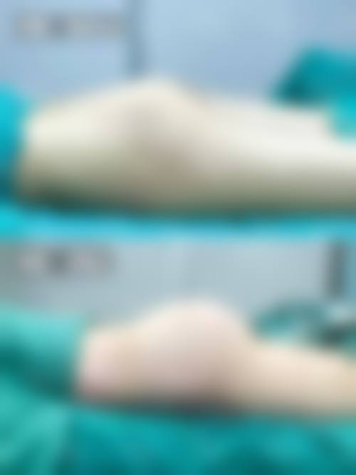 黄疆岚医生坚持个性化定制的诊疗理念