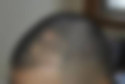 选择黄兆全医生就诊的核心保护