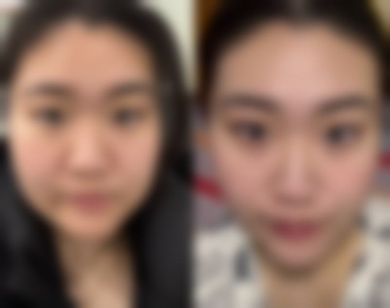 秦瑞雨医生可开展的核心医美项目:注射美容与激光美容全品类