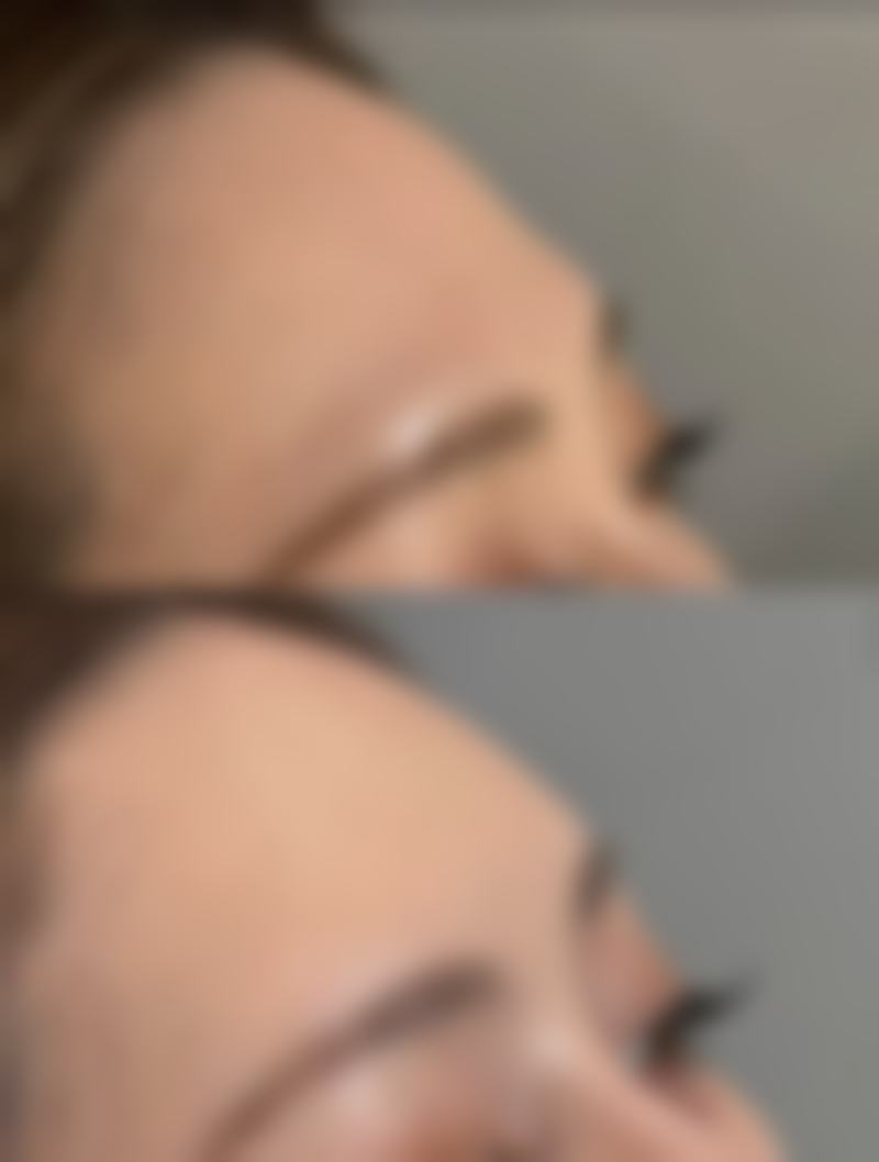 如何预约秦瑞雨医生的医美服务?