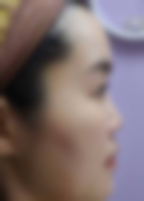 求美者真实反馈