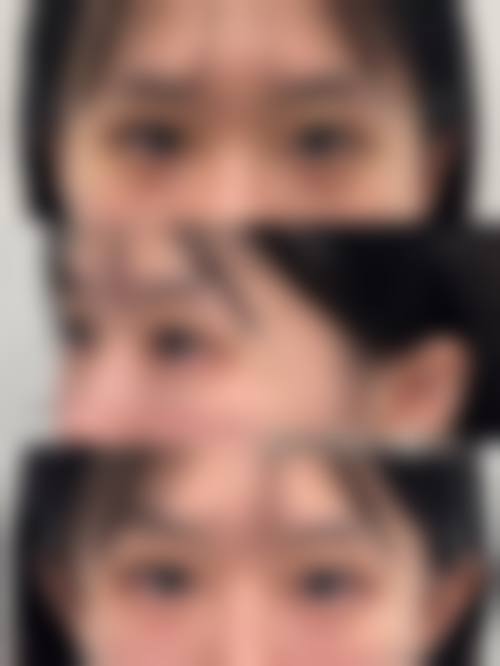 严丽霞医生擅长的皮肤病症精细诊疗