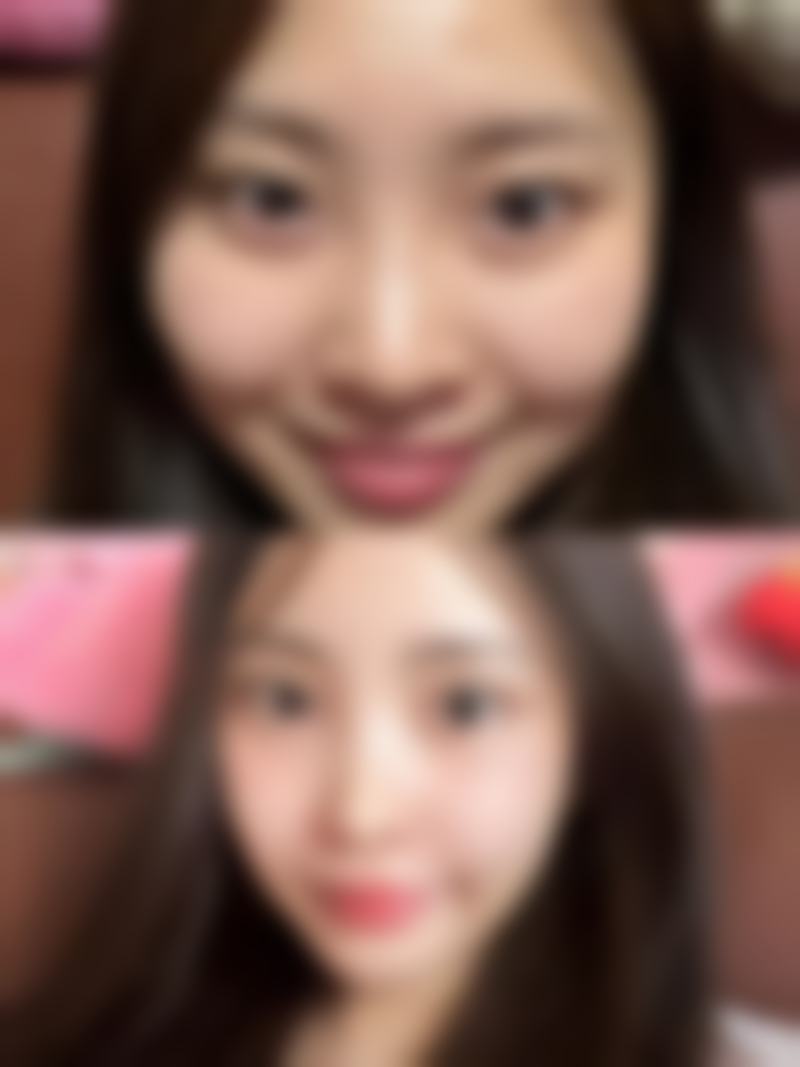 胡竺医生的个性化医美诊疗理念