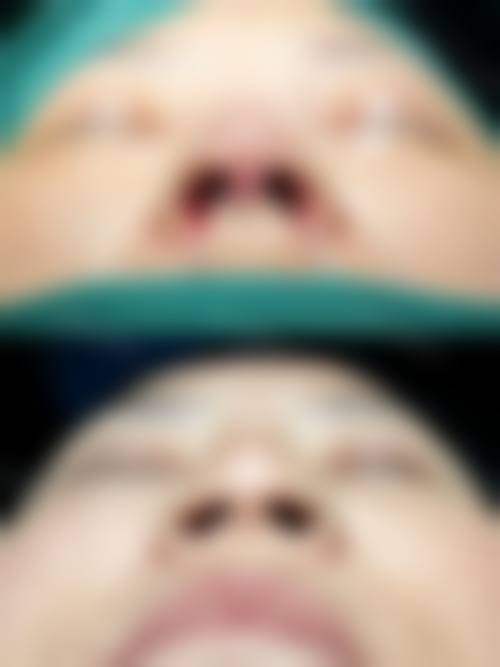 白尚勋医生的全周期术后保护