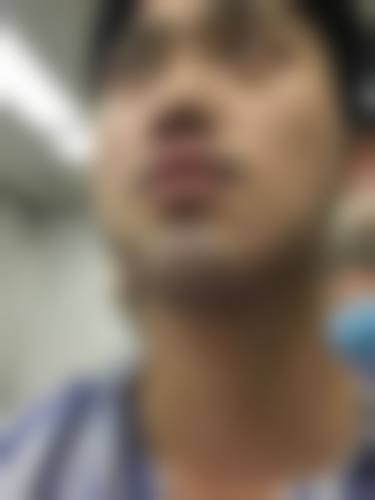 赵正杰可开展的特色医美项目全梳理