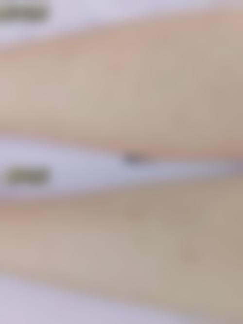 漆淳医生的医美项目收费参考