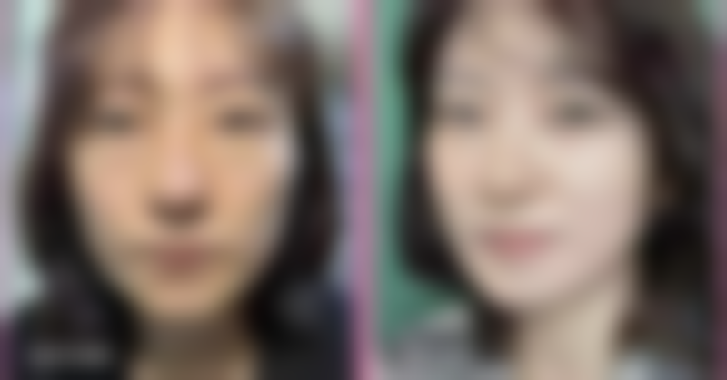 求美者真实反馈