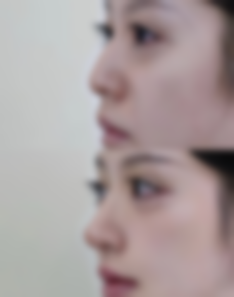 求美者真实反馈