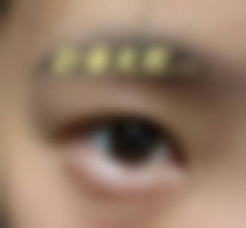 郑东学坚持个性化医美诊疗理念