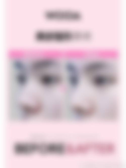 徐赞正的技术特色:韩式精细化医美服务