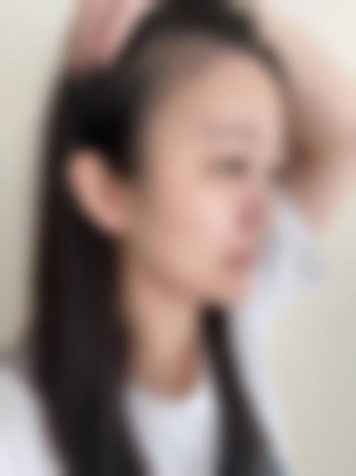 崔硕珉院长的特色精细化医美专长