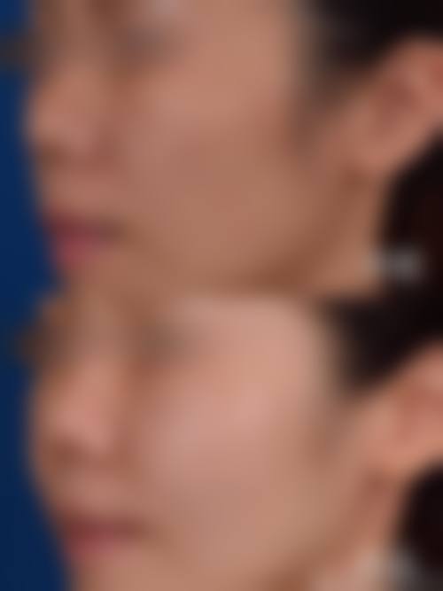 郑美善医生的专属诊疗逻辑：自然和谐，拒绝流水线审美