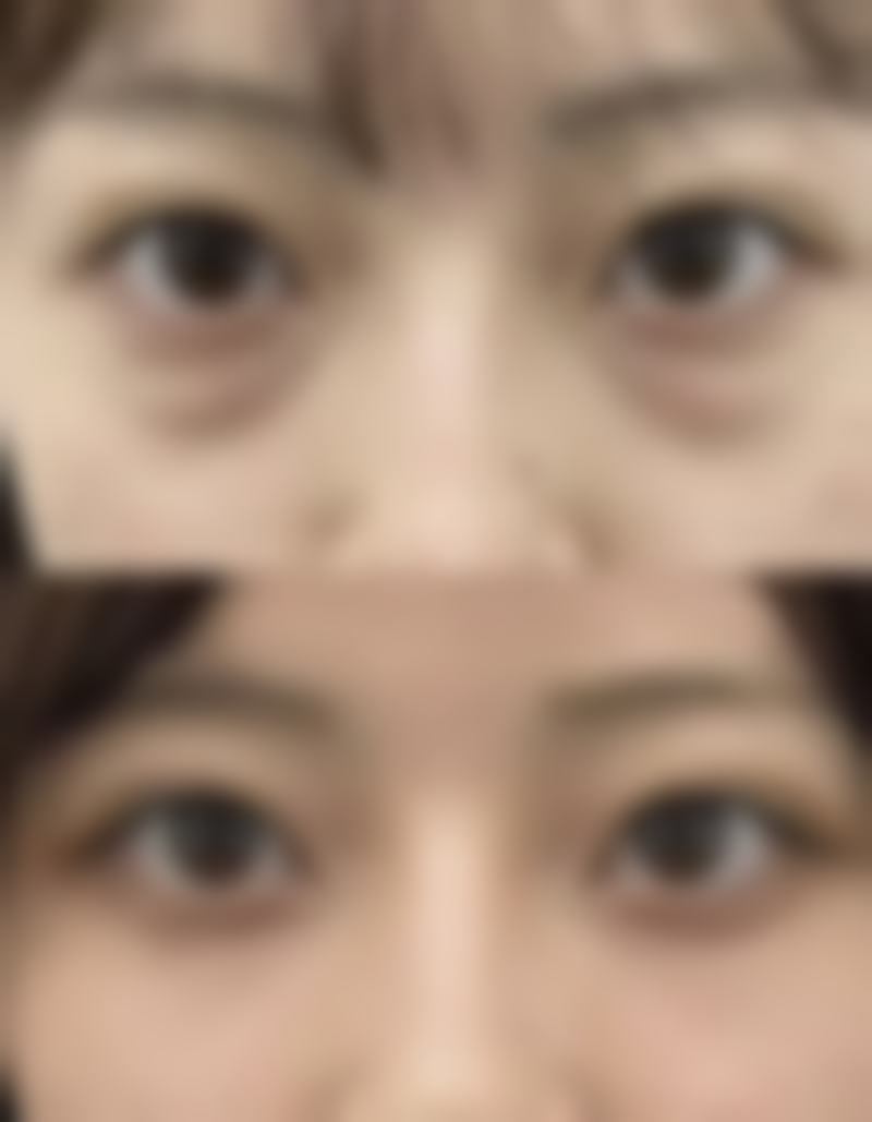 求美者真实反馈