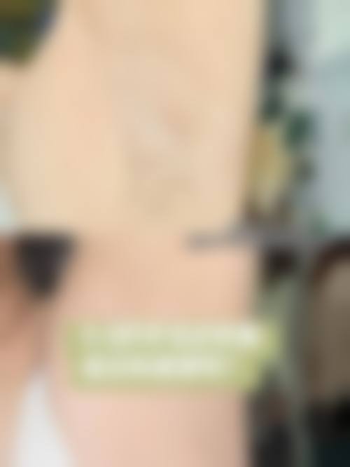 张解生医生的个性化医美诊疗理念