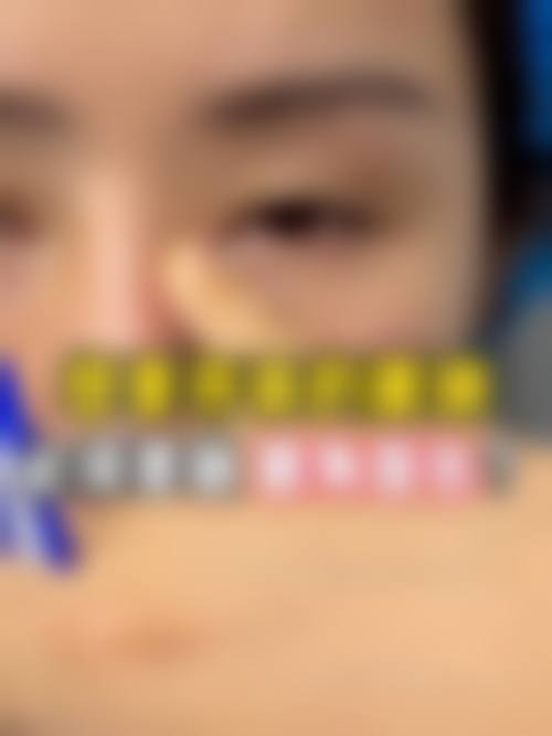 李元医生擅长的特色医美项目范围