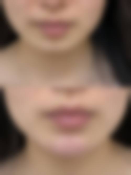 天津滨海新区东江医院求美者反馈