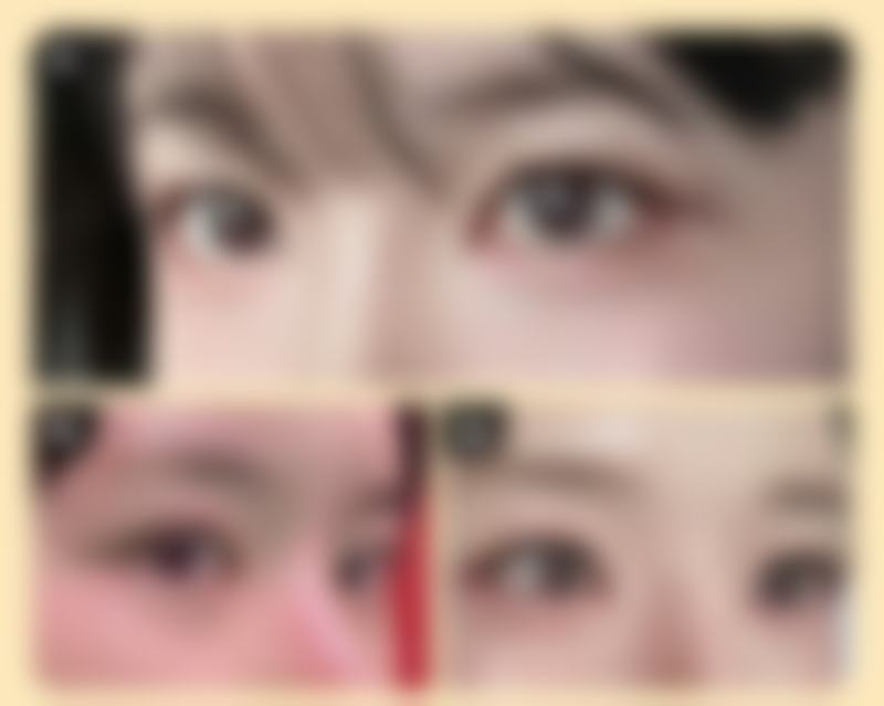 宋静芸医生的特色医美技术优势