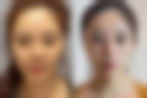 青岛歆美玥整形医院价格收费