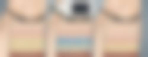 北京新生植发医院特色项目及技术优势