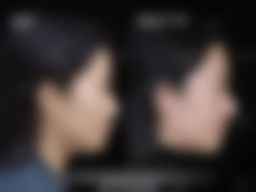 东莞时光整形医疗美容医院求美者反馈