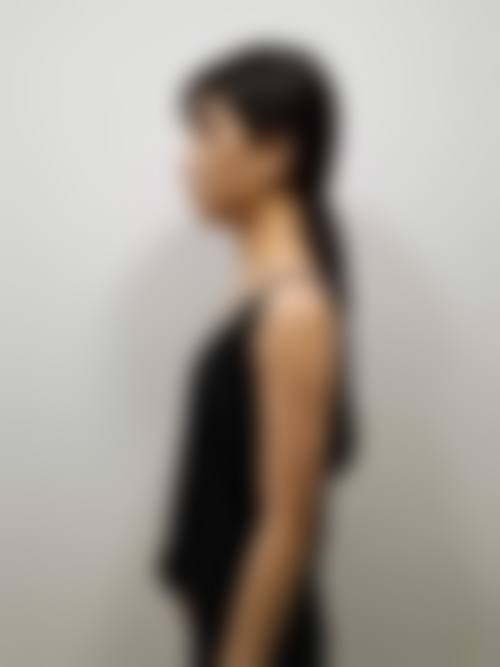 十堰海菲医学整形美容诊所价格收费