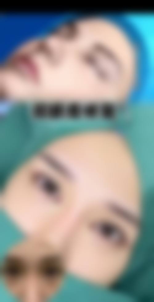 邓德选使用的特色吸脂塑形技术