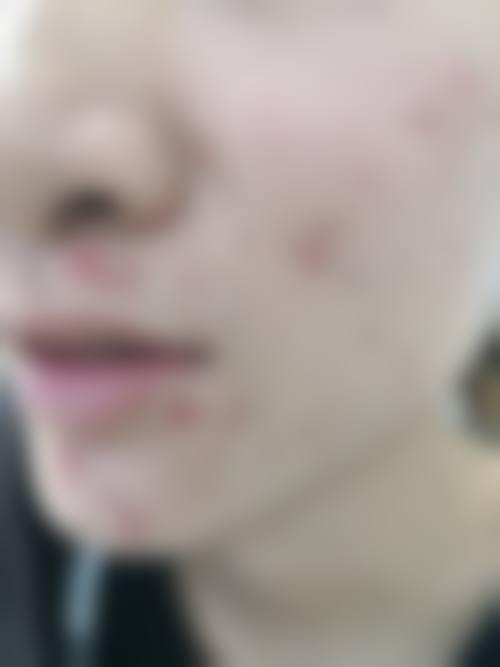 济宁宾梦医疗美容诊所求美者反馈