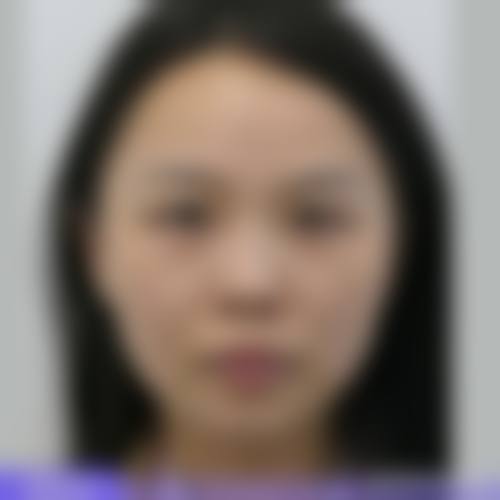 崔金珍医生覆盖全品类医美项目，满足多元变得更美需求