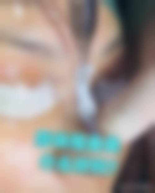 崔金珍医生坚持个性化定制，拒绝千篇一律的变得更美方案