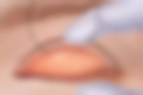 国内人民解放军北部战区总医院（整形美容中 心）特色项目及技术优势