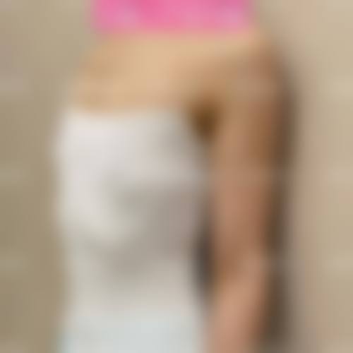 长春艾尔丽整形医疗美容门诊部求美者反馈