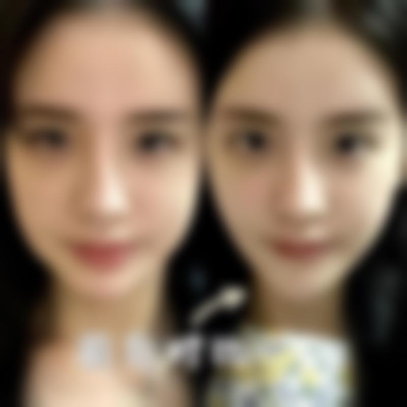 韩国金钟瑞整形外科医院特色项目及技术优势