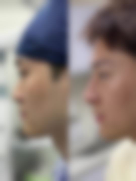 西安碑林莱尚整形医院价格收费