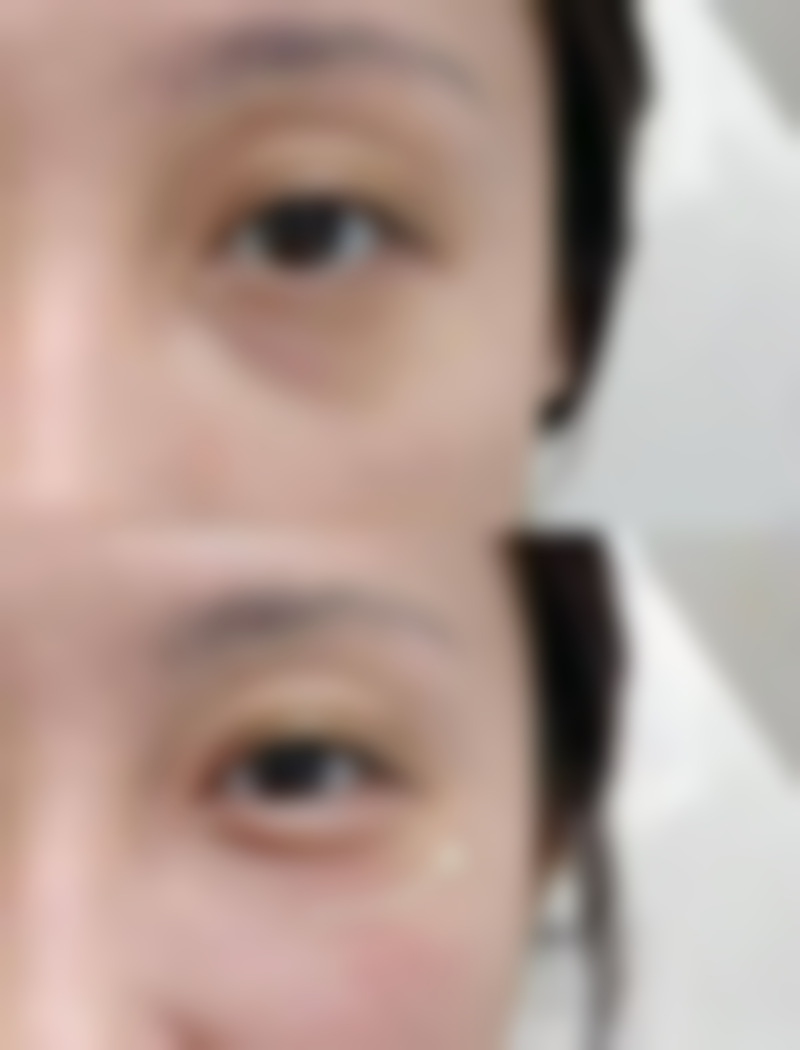 包头陈荣医学整形美容诊所求美者反馈