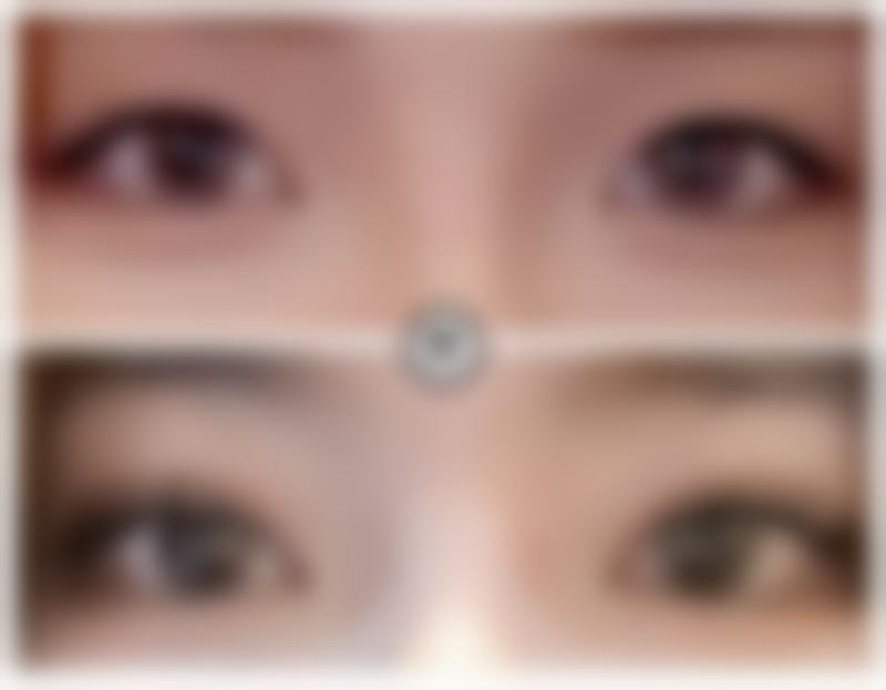 韩国IQ整形外科价格收费