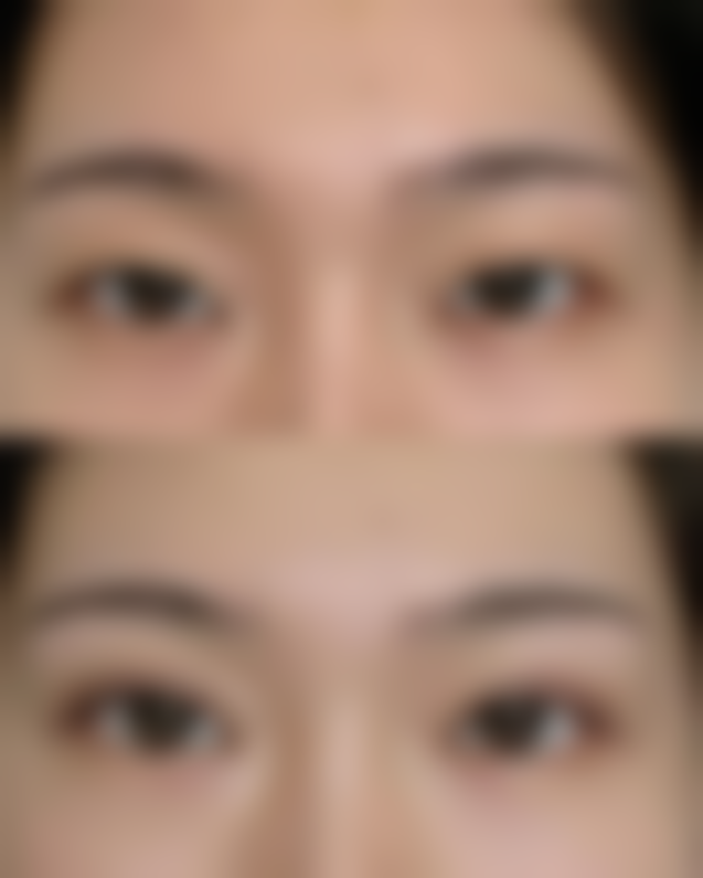 韩国IQ整形外科求美者反馈