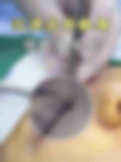 庄蔚强医生的透明收费与安心服务理念