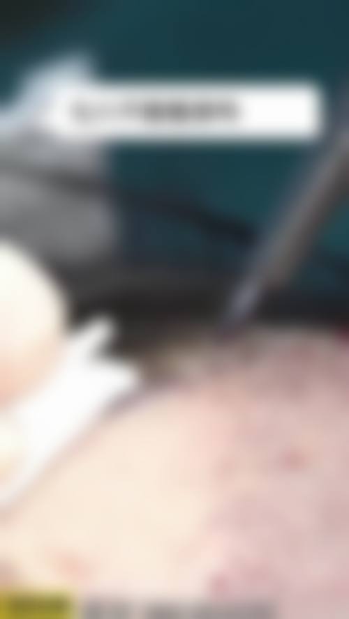 Cham毛发移植医院特色项目及技术优势