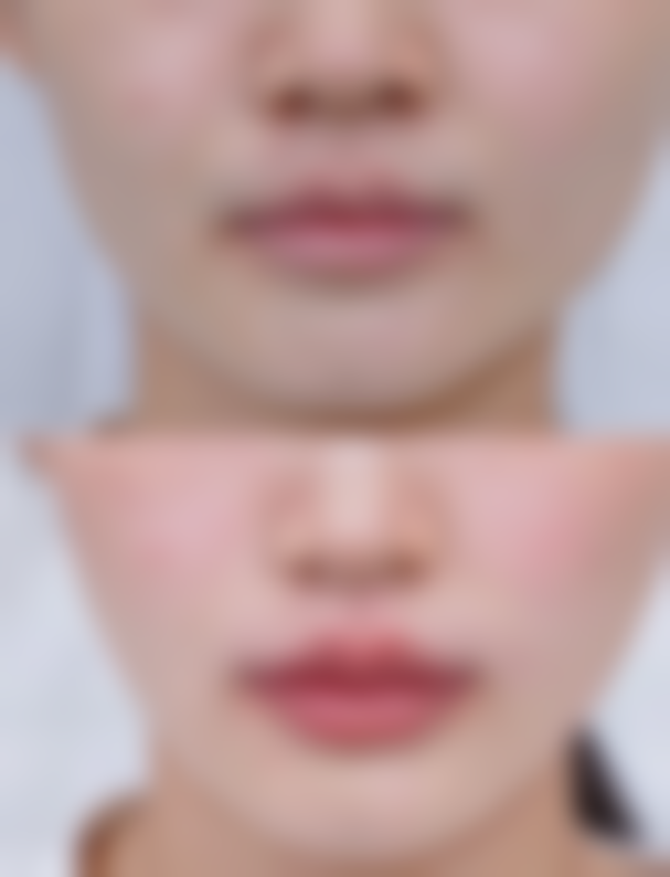 延吉艾尚丽格医学整形美容诊所特色项目及技术优势