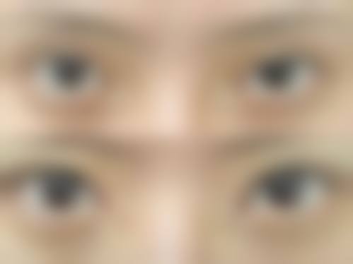 海口添美整形美容诊所价格收费