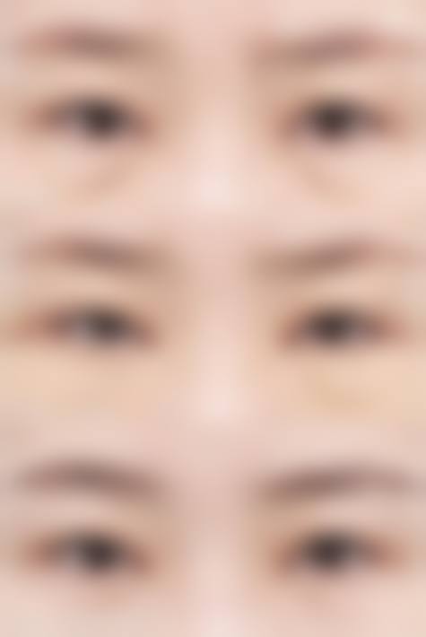 柳锡泰院长：毛发移植与皮肤美容的高能医美骨干医生