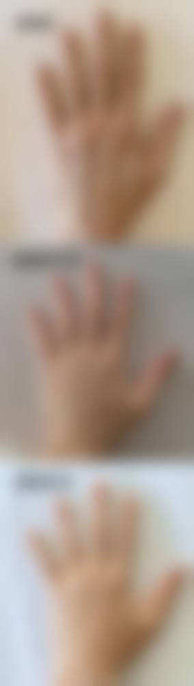 西安阿狸佑美医疗美容诊所来院路线