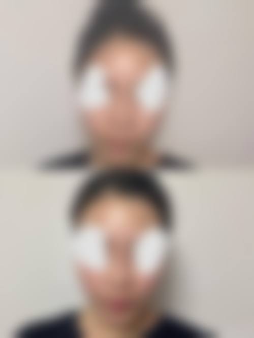 胡晓波医生：以求美者为中 心的精细化诊疗思路