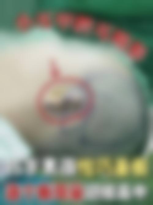 兖矿新里程总医院(烧伤整形科)求美者反馈