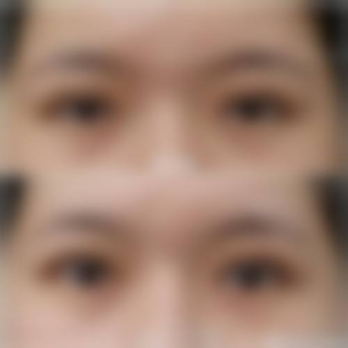 韩国普拉美斯整形医院：柳锡泰院长坐诊的正规医美机构